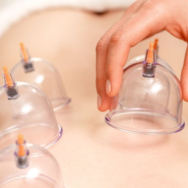 Cupping at Back Into Motion