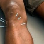 Article Chronic Pain Relief image 5